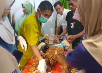 Pertolongan Sang Ibu, Bocah 9 Tahun Selamat dari Serangan Buaya