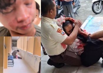 Heboh Pembacokan Mahasiswi di Kampus UIN Suska Riau