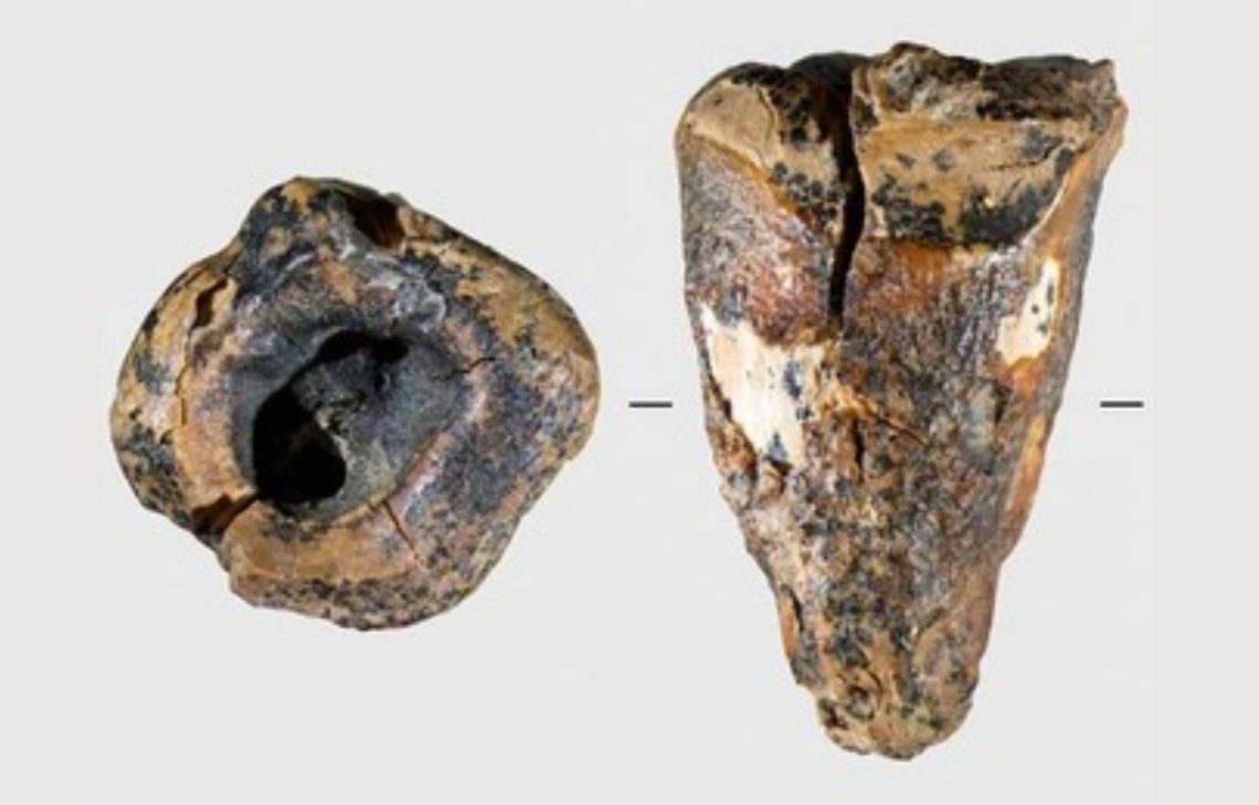 Operasi Gigi Tertua di Dunia Ditemukan, Neanderthal Lakukan 59.000 Tahun Lalu di Siberia