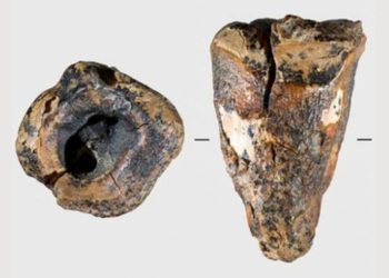 Operasi Gigi Tertua di Dunia Ditemukan, Neanderthal Lakukan 59.000 Tahun Lalu di Siberia