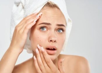 Rekomendasi 4 Physical Sunscreen Terbaik untuk Kulit Berjerawat dan Sensitif