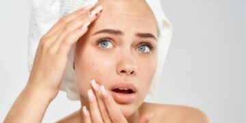 Rekomendasi 4 Physical Sunscreen Terbaik untuk Kulit Berjerawat dan Sensitif