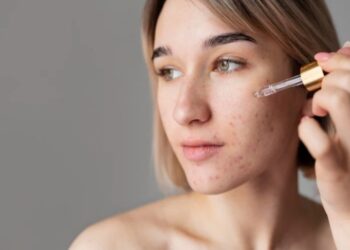 4 Pilihan Serum Lokal Terbaik Menghilangkan Flek Hitam, Cocok untuk Usia 30 ke Atas