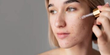 4 Pilihan Serum Lokal Terbaik Menghilangkan Flek Hitam, Cocok untuk Usia 30 ke Atas